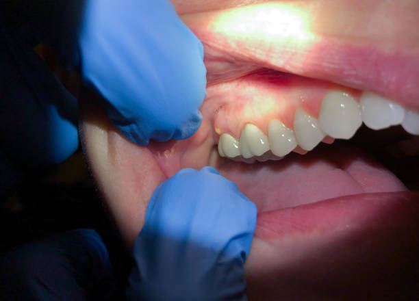 Best Walk-In Emergency Dental Services in Tuscola, IL