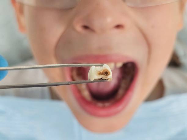 Best Emergency Orthodontic Repairs in Tuscola, IL