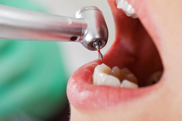 Best Emergency Root Canal Therapy in Tuscola, IL